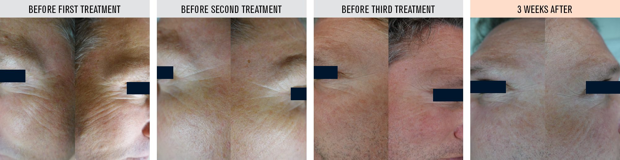 reboost-before-and-after2 reboost-before-and-after2